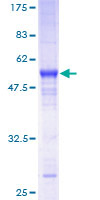 RIT2 / RIN Protein - 12.5% SDS-PAGE of human RIT2 stained with Coomassie Blue