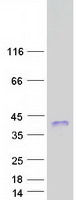 RITA1 / C12orf52 Protein - Purified recombinant protein RITA1 was analyzed by SDS-PAGE gel and Coomassie Blue Staining