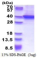 RLBP1 / CRALBP Protein