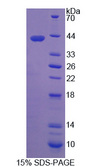 RLBP1 / CRALBP Protein - Recombinant Retinaldehyde Binding Protein 1 By SDS-PAGE