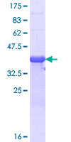 RLF Protein - 12.5% SDS-PAGE Stained with Coomassie Blue.