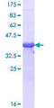 RLF Protein - 12.5% SDS-PAGE Stained with Coomassie Blue.