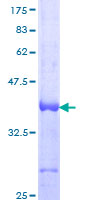 RLIM / RNF12 Protein
