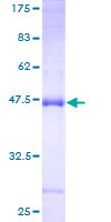 RLN1 / Relaxin Protein - 12.5% SDS-PAGE of human RLN1 stained with Coomassie Blue