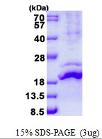 RLN2 / Relaxin 2 Protein