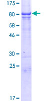 RMDN3 Protein - 12.5% SDS-PAGE of human FAM82C stained with Coomassie Blue