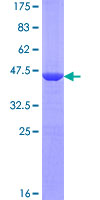 RMI2 / C16orf75 Protein - 12.5% SDS-PAGE of human RMI2 stained with Coomassie Blue