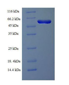RMND5A Protein