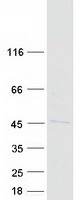 RMND5B Protein - Purified recombinant protein RMND5B was analyzed by SDS-PAGE gel and Coomassie Blue Staining