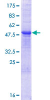 RNASE10 Protein - 12.5% SDS-PAGE of human RNASE10 stained with Coomassie Blue