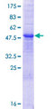 RNASE10 Protein - 12.5% SDS-PAGE of human RNASE10 stained with Coomassie Blue