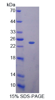 RNASE11 Protein - Recombinant  Ribonuclease A11 By SDS-PAGE