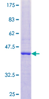 RNASE2 / EDN Protein - 12.5% SDS-PAGE of human RNASE2 stained with Coomassie Blue