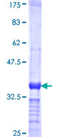 RNASE2 / EDN Protein - 12.5% SDS-PAGE Stained with Coomassie Blue.