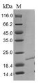 RNASE4 Protein - (Tris-Glycine gel) Discontinuous SDS-PAGE (reduced) with 5% enrichment gel and 15% separation gel.
