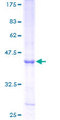 RNASE6 Protein - 12.5% SDS-PAGE of human RNASE6 stained with Coomassie Blue