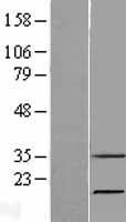 RNASE7 Protein - Western validation with an anti-DDK antibody * L: Control HEK293 lysate R: Over-expression lysate