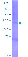 RNASE7 Protein - 12.5% SDS-PAGE of human RNASE7 stained with Coomassie Blue