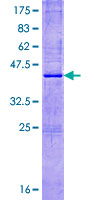 RNASE8 Protein - 12.5% SDS-PAGE of human RNASE8 stained with Coomassie Blue