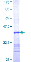 RNASEH1 Protein - 12.5% SDS-PAGE Stained with Coomassie Blue.