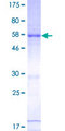 RNASEH2A Protein - 12.5% SDS-PAGE of human RNASEH2A stained with Coomassie Blue
