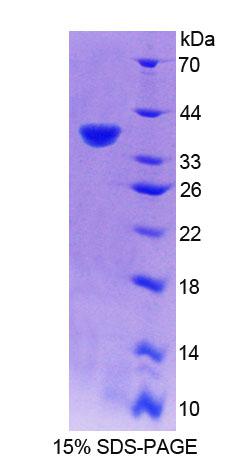 RNASEH2A Protein - Recombinant Ribonuclease H2 Subunit A (RNASEH2A) by SDS-PAGE