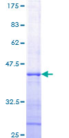 RNASEL / RNase L Protein - 12.5% SDS-PAGE Stained with Coomassie Blue.
