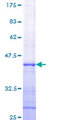 RNASEL / RNase L Protein - 12.5% SDS-PAGE Stained with Coomassie Blue.