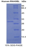 RNASEL / RNase L Protein - Recombinant Ribonuclease L By SDS-PAGE