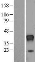 RNASET2 Protein - Western validation with an anti-DDK antibody * L: Control HEK293 lysate R: Over-expression lysate
