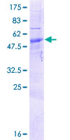 RNASET2 Protein - 12.5% SDS-PAGE of human RNASET2 stained with Coomassie Blue