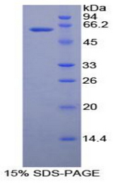 RNASET2 Protein - Recombinant Ribonuclease T2 By SDS-PAGE