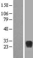 RND2 Protein - Western validation with an anti-DDK antibody * L: Control HEK293 lysate R: Over-expression lysate