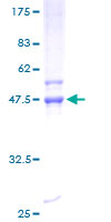 RND2 Protein - 12.5% SDS-PAGE of human RND2 stained with Coomassie Blue