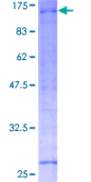 RNF10 Protein - 12.5% SDS-PAGE of human RNF10 stained with Coomassie Blue