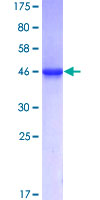 RNF11 Protein - 12.5% SDS-PAGE of human RNF11 stained with Coomassie Blue