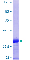 RNF11 Protein - 12.5% SDS-PAGE Stained with Coomassie Blue.