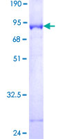 RNF113A Protein - 12.5% SDS-PAGE of human RNF113A stained with Coomassie Blue