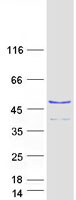 RNF113A Protein - Purified recombinant protein RNF113A was analyzed by SDS-PAGE gel and Coomassie Blue Staining