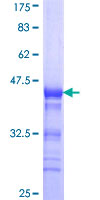 RNF113B Protein - 12.5% SDS-PAGE Stained with Coomassie Blue.