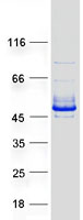 RNF113B Protein - Purified recombinant protein RNF113B was analyzed by SDS-PAGE gel and Coomassie Blue Staining