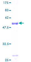 RNF114 / ZNF313 Protein - 12.5% SDS-PAGE of human ZNF313 stained with Coomassie Blue