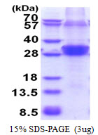 RNF114 / ZNF313 Protein