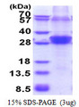 RNF114 / ZNF313 Protein