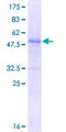 RNF115 / BCA2 Protein - 12.5% SDS-PAGE of human ZNF364 stained with Coomassie Blue