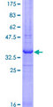 RNF121 Protein - 12.5% SDS-PAGE Stained with Coomassie Blue.