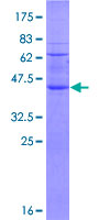 RNF122 Protein - 12.5% SDS-PAGE of human RNF122 stained with Coomassie Blue