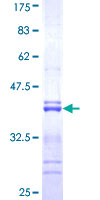 RNF123 Protein - 12.5% SDS-PAGE Stained with Coomassie Blue.