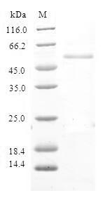 RNF125 / TRAC-1 Protein - (Tris-Glycine gel) Discontinuous SDS-PAGE (reduced) with 5% enrichment gel and 15% separation gel.