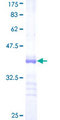 RNF125 / TRAC-1 Protein - 12.5% SDS-PAGE Stained with Coomassie Blue.